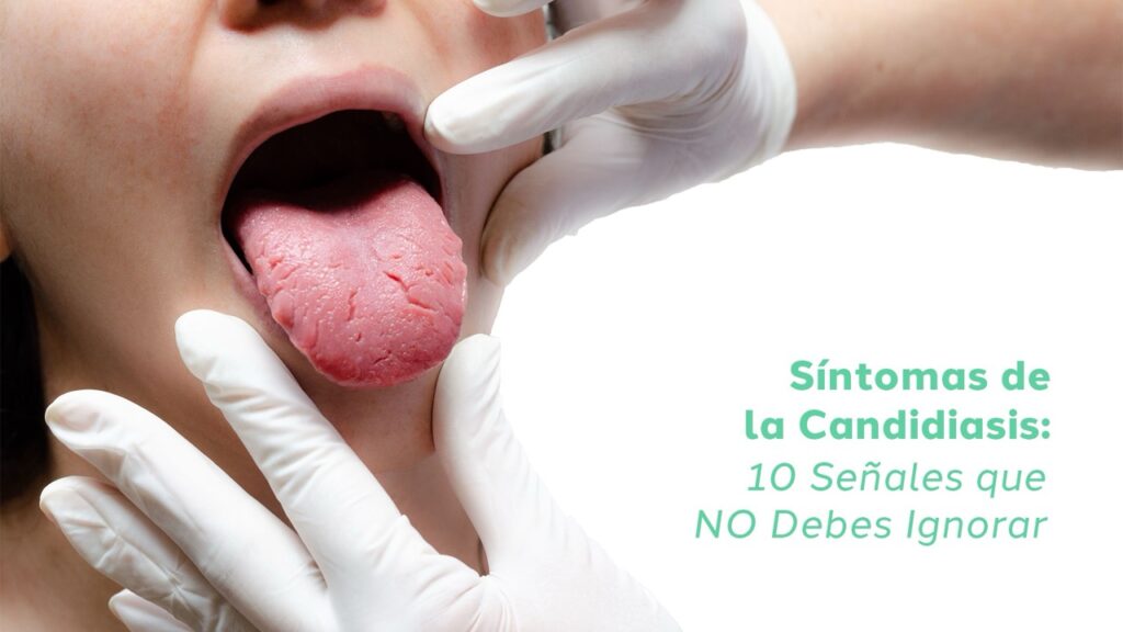 Síntomas de la Banner Blog Candidiasis 10 Señales que No Debes Ignorar